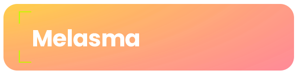 melasma